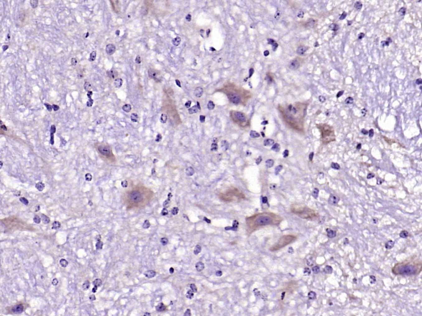Anti-Fibronectin Polyclonal Antibody