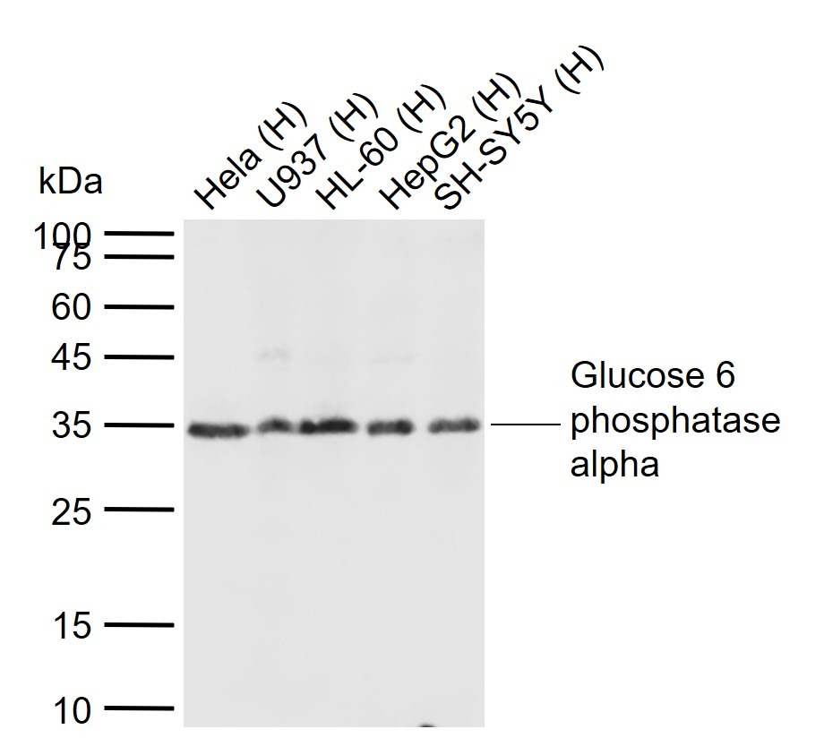 Anti-G6PC Polyclonal Antibody