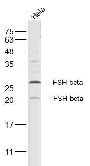 Anti-FSH beta Polyclonal Antibody