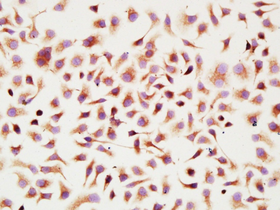 Anti-Fibronectin Polyclonal Antibody 2