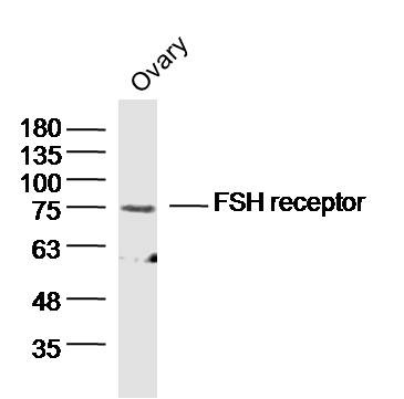 Anti-FSHR Polyclonal Antibody 2