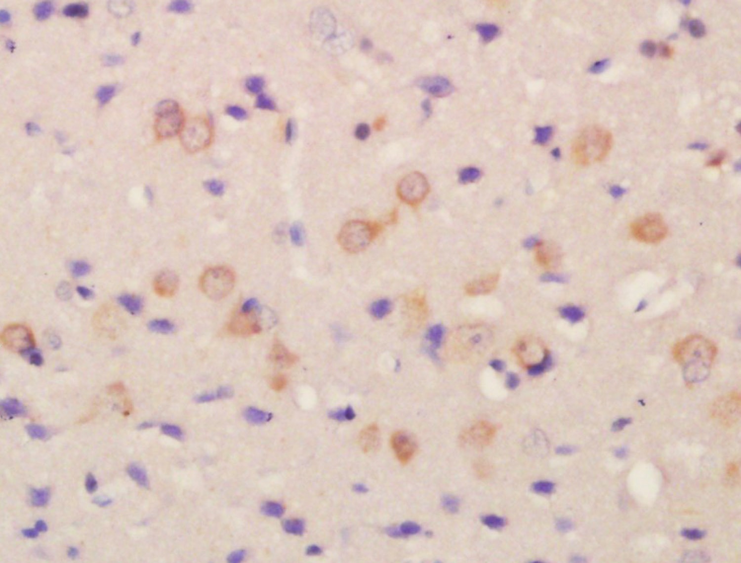 Anti-FLRT2 Polyclonal Antibody