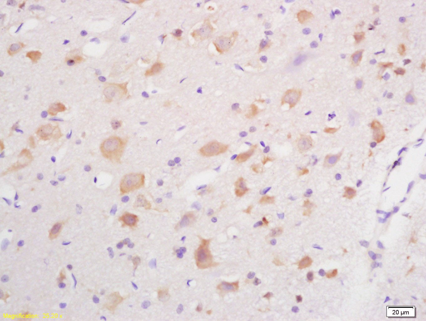 Anti-GABA A Receptor gamma 2 Polyclonal Antibody