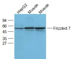 Anti-FZD7 Polyclonal Antibody