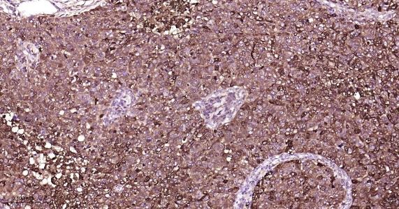 Anti-FTH Antibody (9C880)