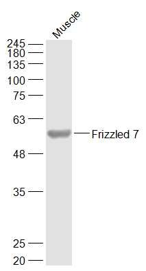 Anti-FZD7 Polyclonal Antibody