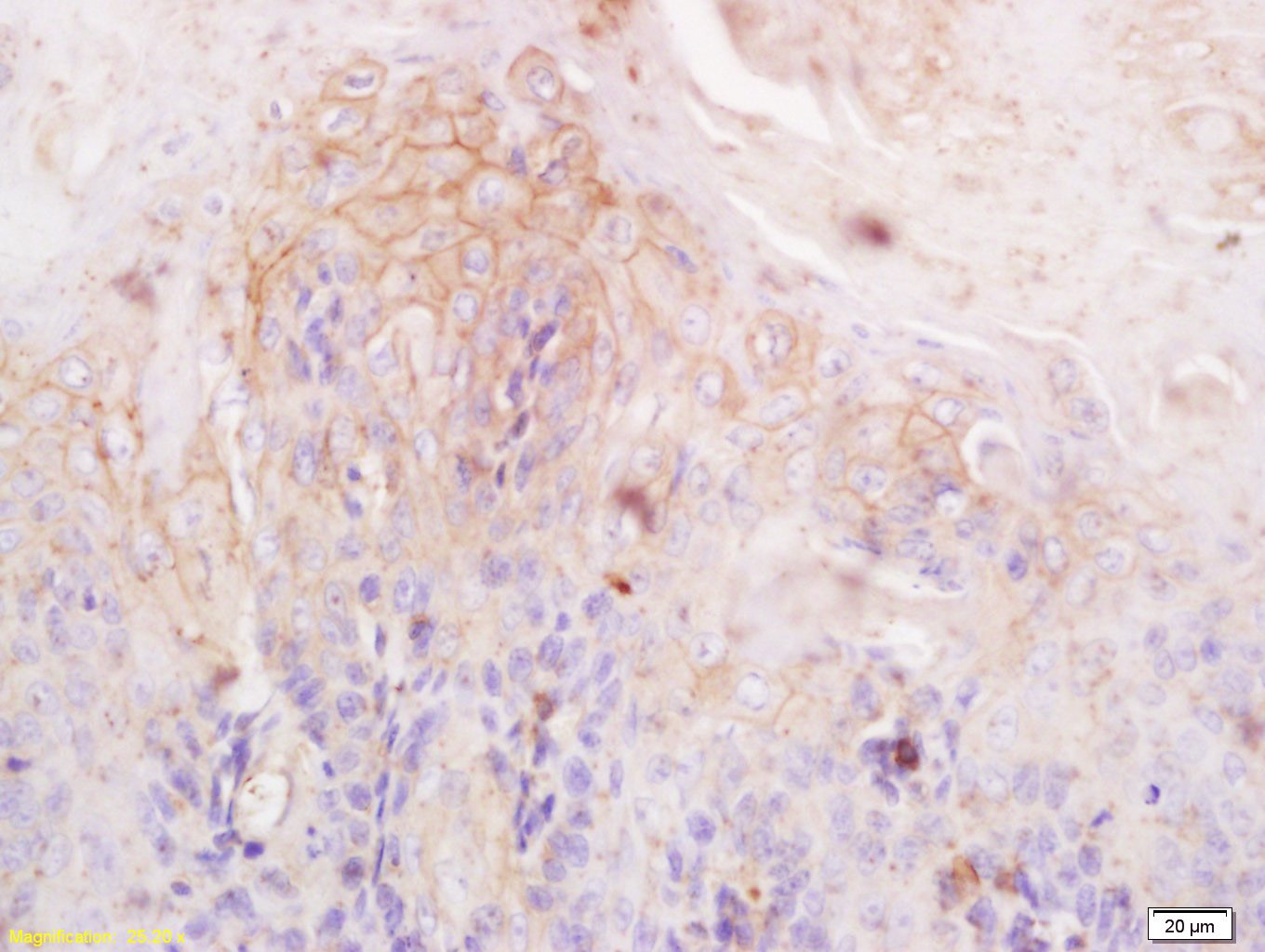 Anti-Filaggrin Polyclonal Antibody
