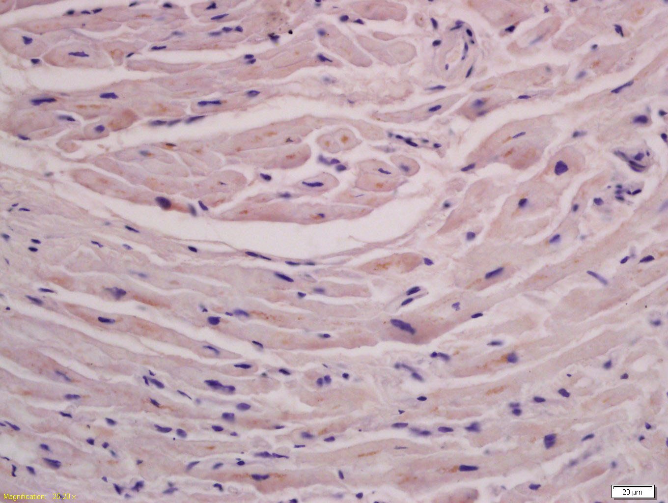 Anti-FLNC Polyclonal Antibody