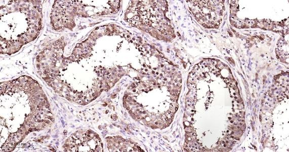 Anti-FTH Antibody (9C880)