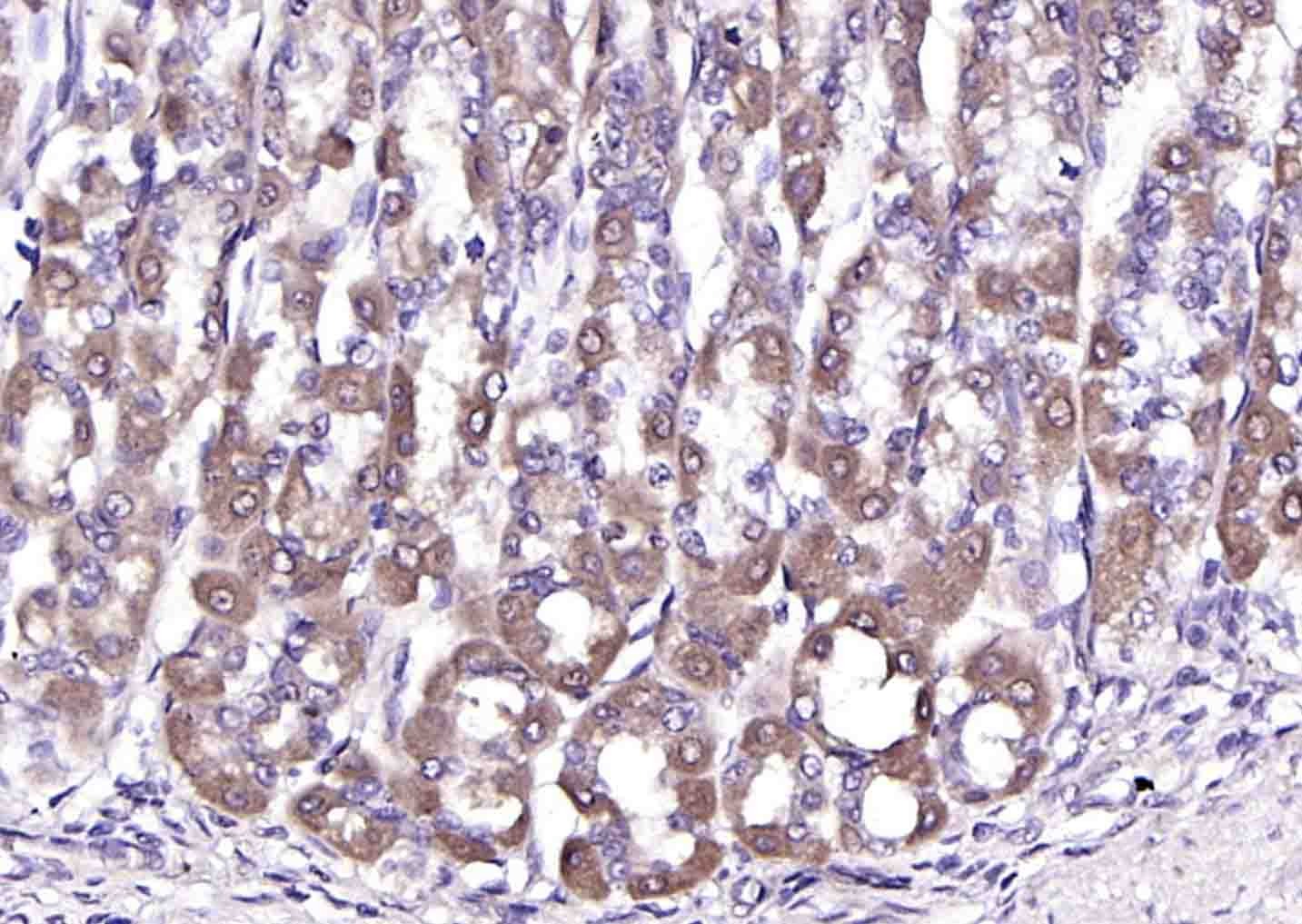 Anti-FLNC Polyclonal Antibody