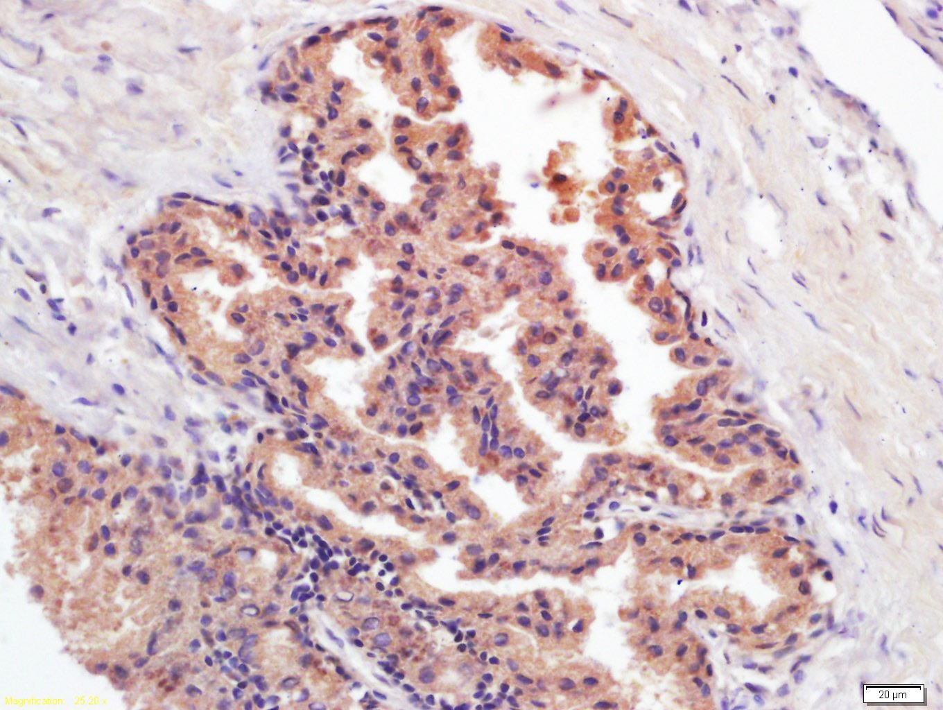 Anti-Kallikrein 3/KLK3 Antibody (6R985)
