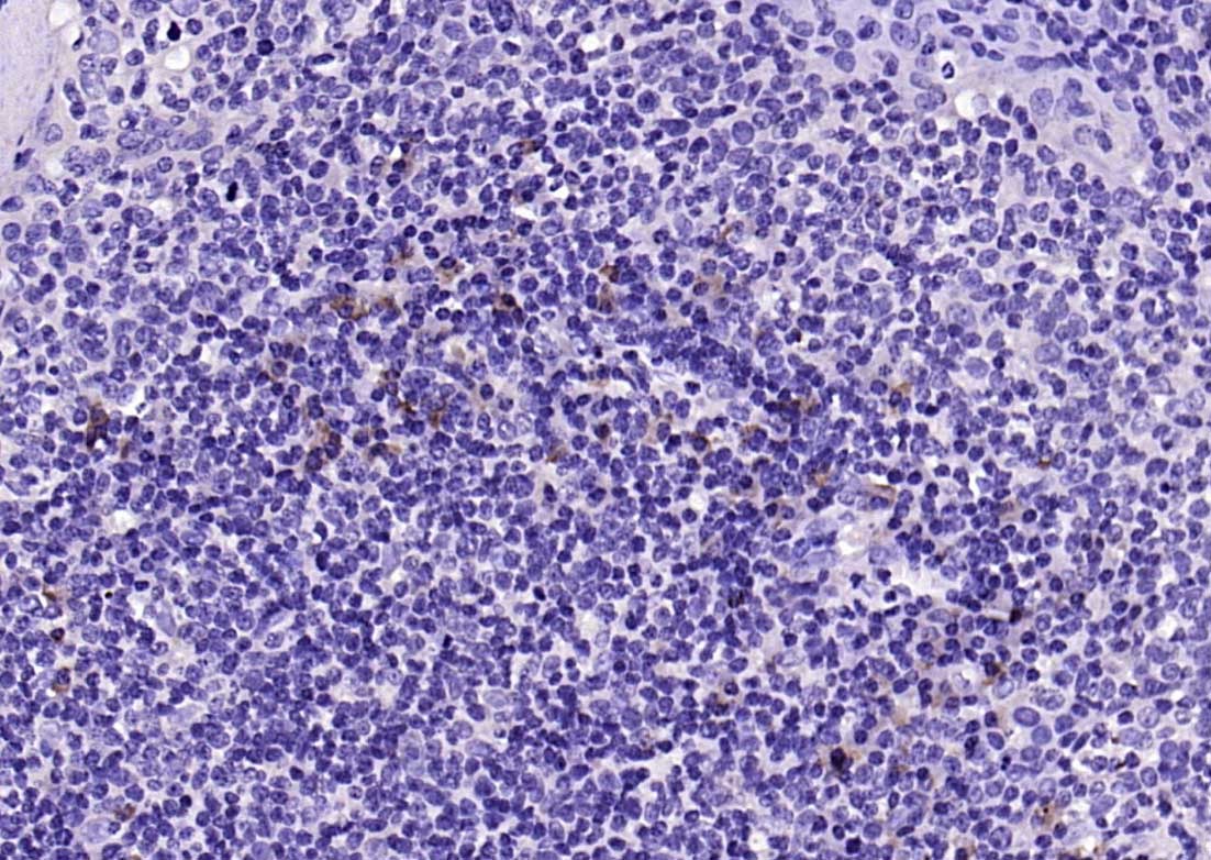 Anti-IL-2 Polyclonal Antibody