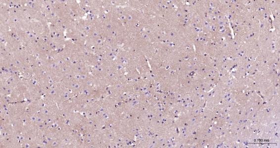 Anti-ITGAV Polyclonal Antibody