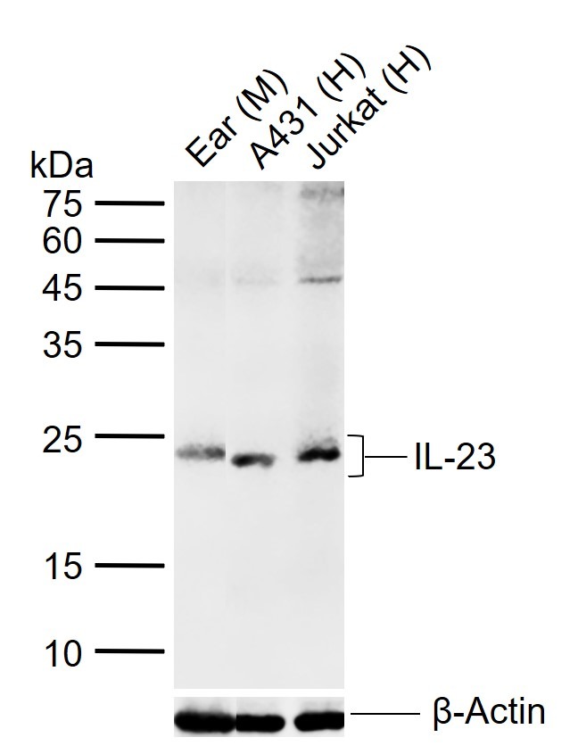 Anti-IL-23 Polyclonal Antibody