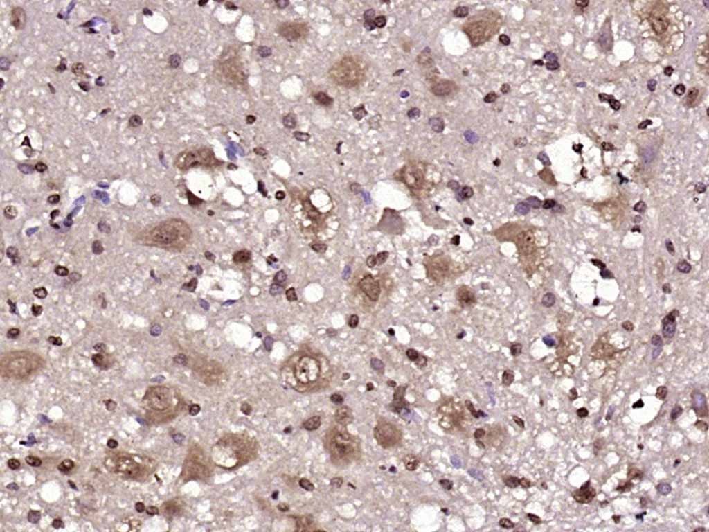 Anti-JNK1/2/3 Polyclonal Antibody