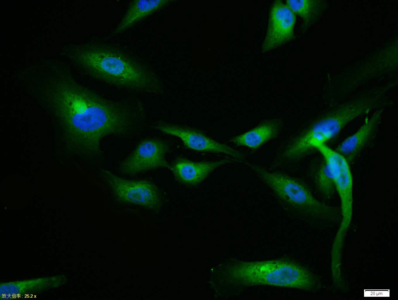 Anti-ITGAV Polyclonal Antibody 2