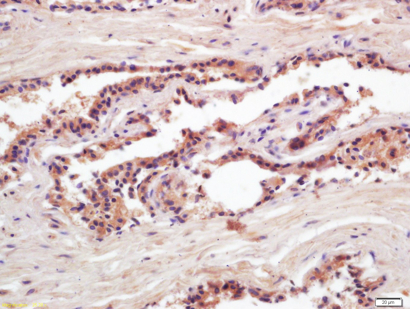 Anti-Kallikrein 3/KLK3 Antibody (1V837)