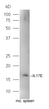 Anti-IL-25/IL-17E Polyclonal Antibody