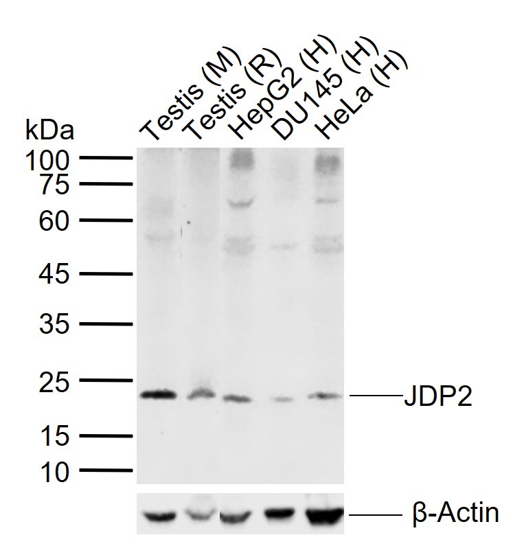 Anti-JDP2 Polyclonal Antibody