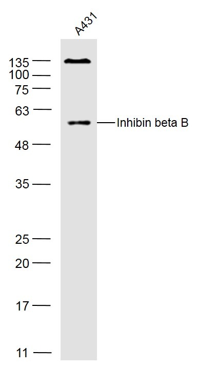 Anti-INHBB Polyclonal Antibody