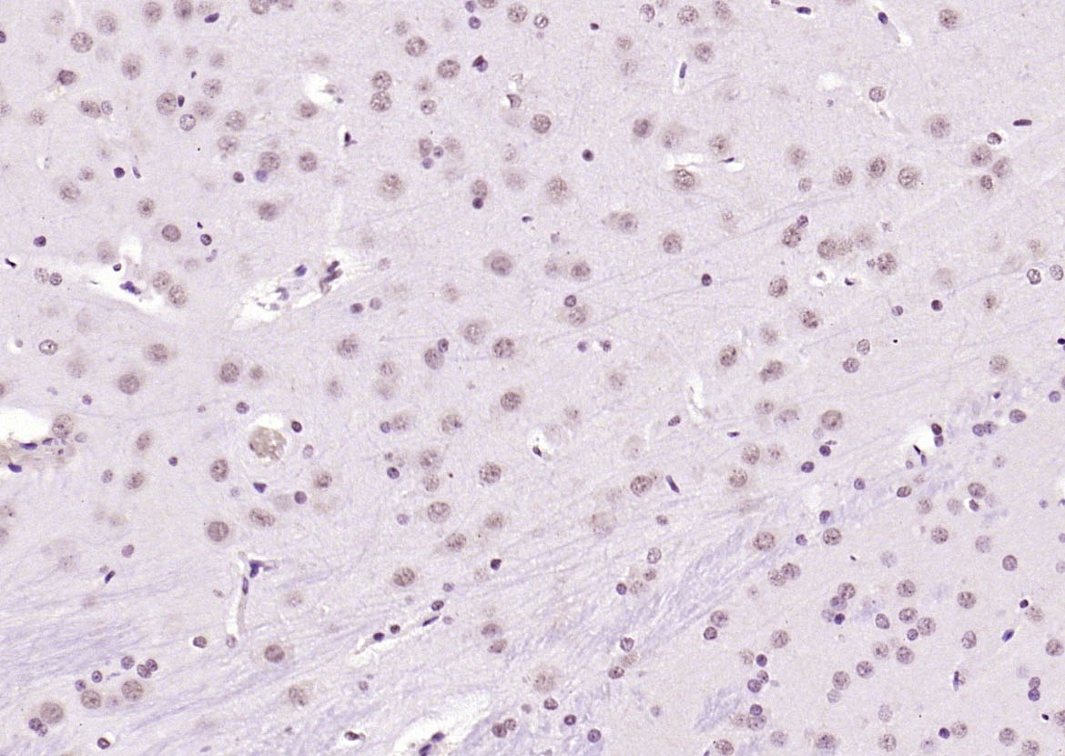 Anti-KEAP1 Polyclonal Antibody 2