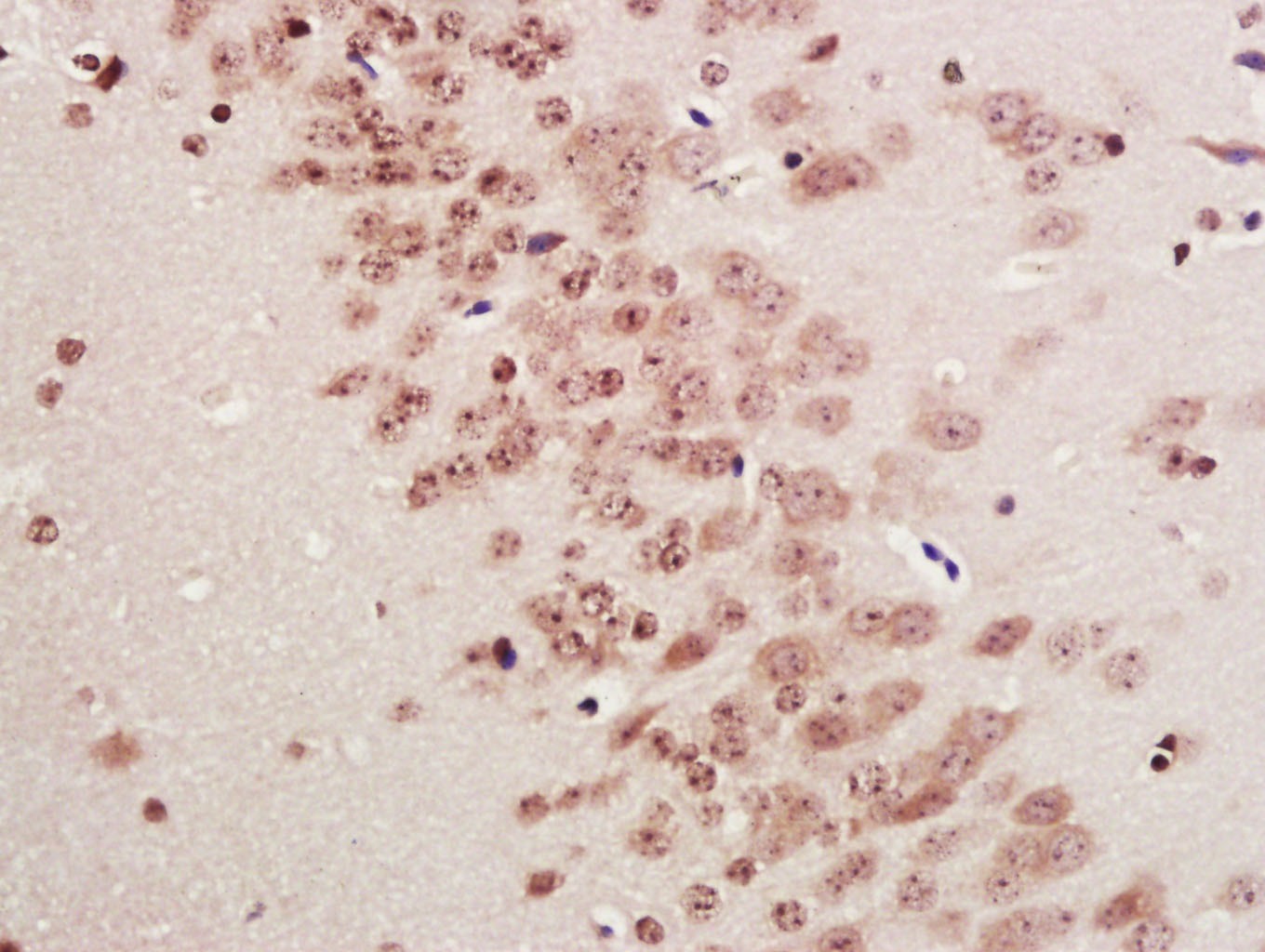 Anti-KEAP1 Polyclonal Antibody 2