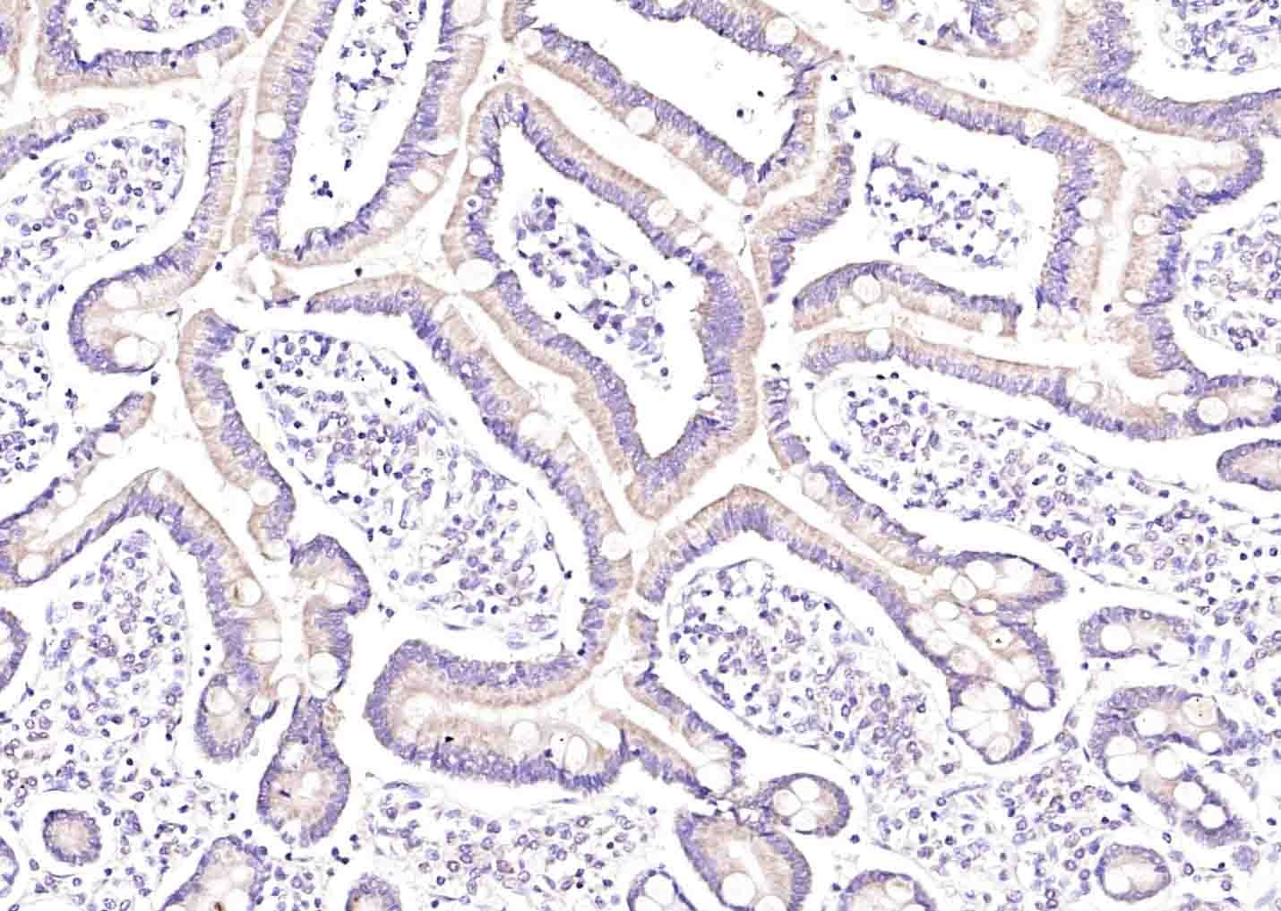 Anti-IL-34 Polyclonal Antibody