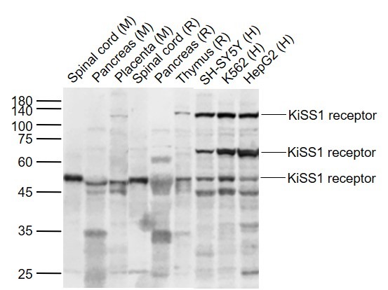 Anti-KISS1 receptor Polyclonal Antibody