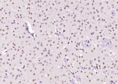 Anti-KEAP1 Polyclonal Antibody