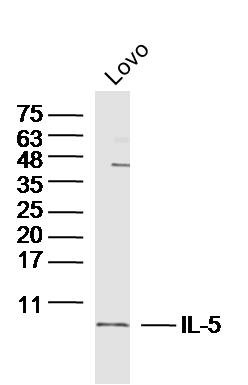 Anti-IL-5 Polyclonal Antibody