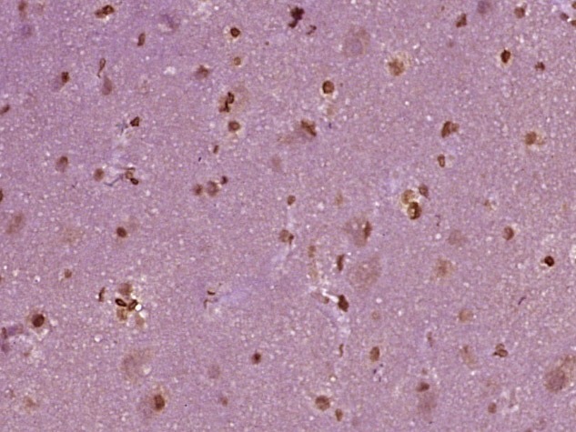 Anti-KEAP1 Polyclonal Antibody