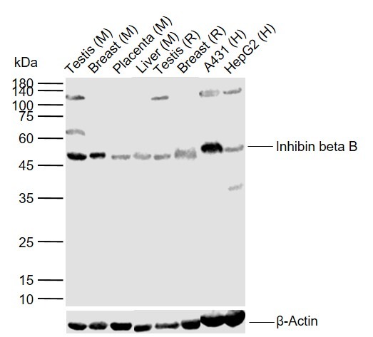 Anti-INHBB Polyclonal Antibody