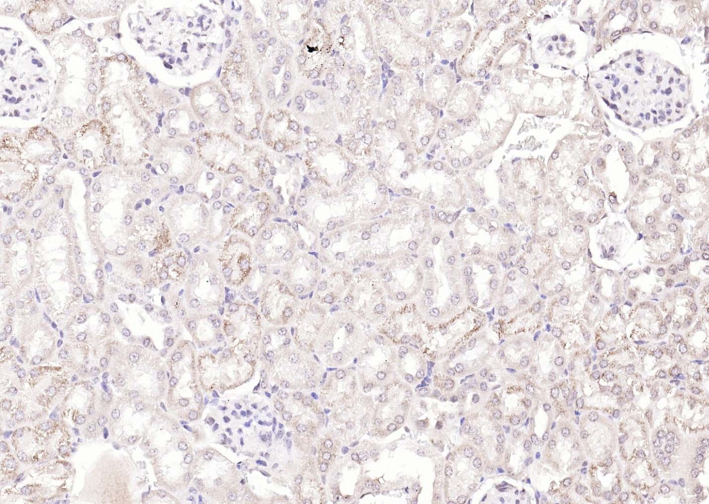 Anti-KIBRA Polyclonal Antibody