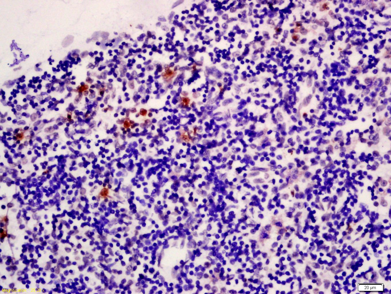 Anti-INHA Polyclonal Antibody