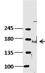 Anti-KDM6B Polyclonal Antibody