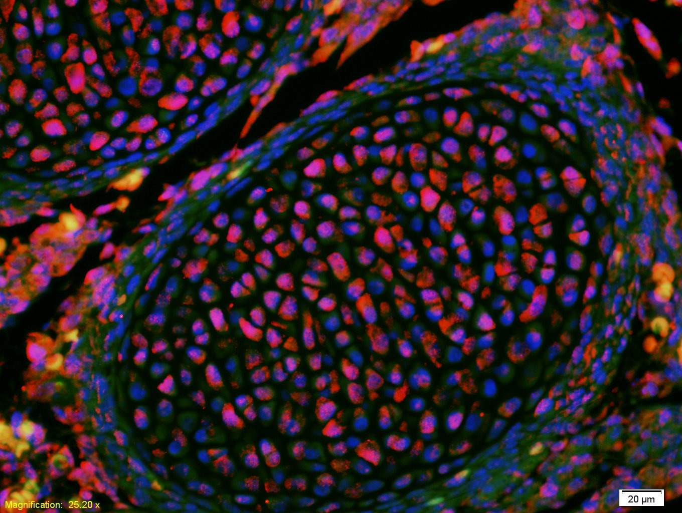 Anti-KLF2 Polyclonal Antibody