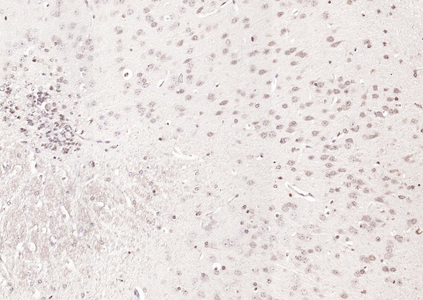Anti-KIBRA Polyclonal Antibody