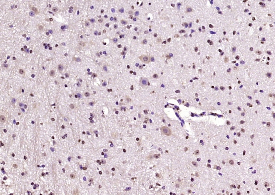 Anti-KIAA2022 Polyclonal Antibody