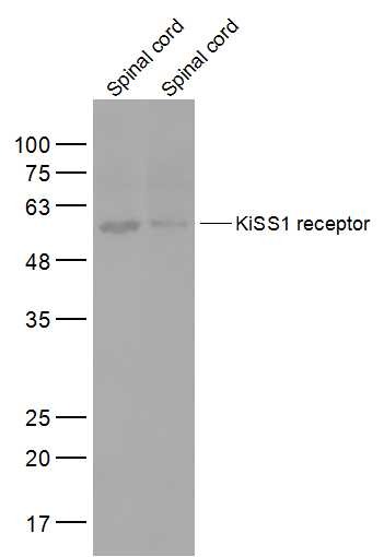 Anti-KISS1 receptor Polyclonal Antibody
