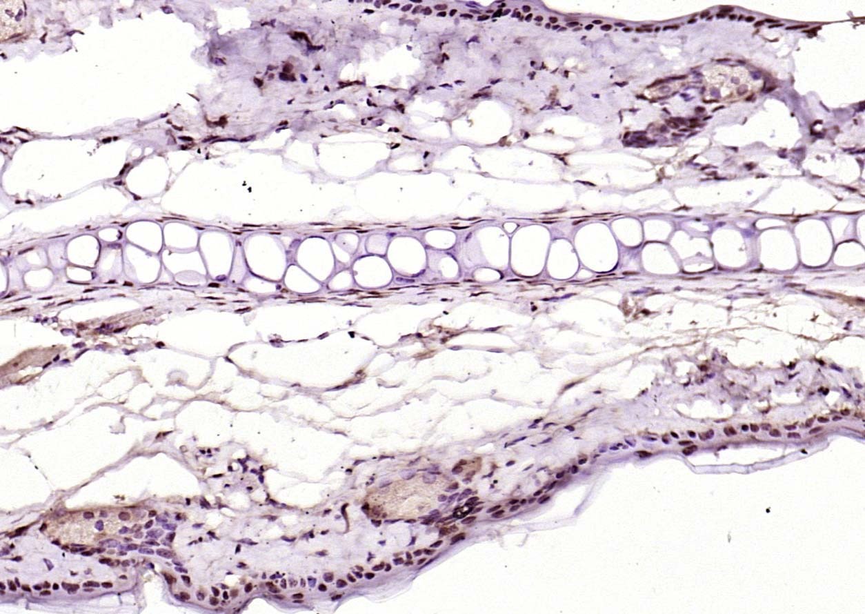 Anti-KEAP1 Polyclonal Antibody 2