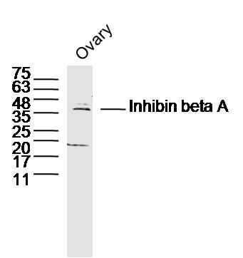 Anti-INHBA Polyclonal Antibody