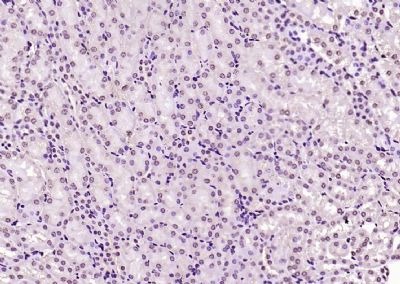 Anti-KEAP1 Polyclonal Antibody