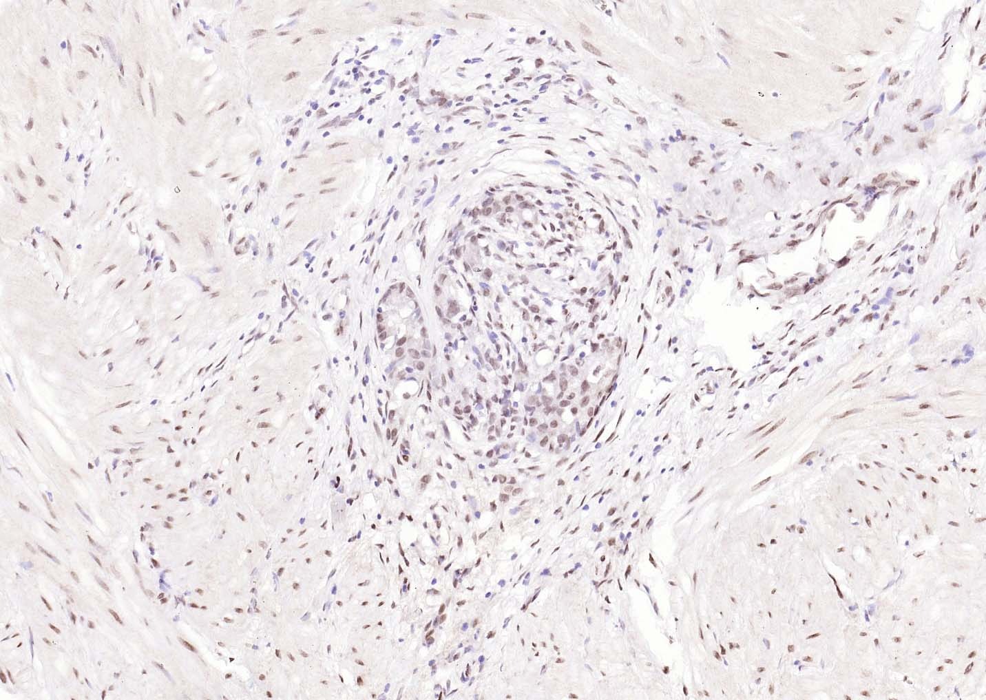 Anti-KIBRA Polyclonal Antibody