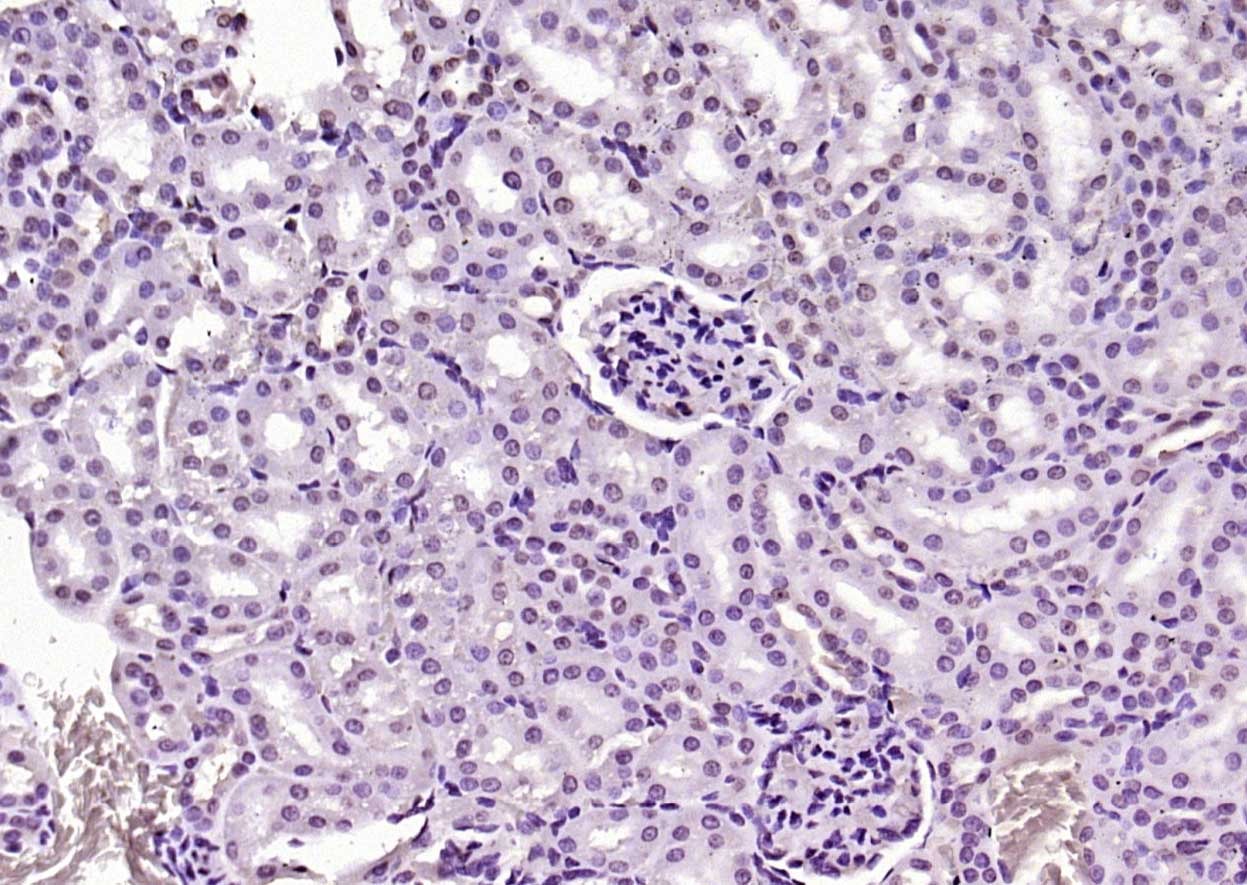 Anti-KEAP1 Polyclonal Antibody 2