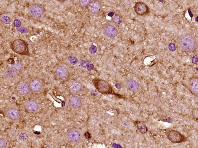 Anti-KISS1 Polyclonal Antibody