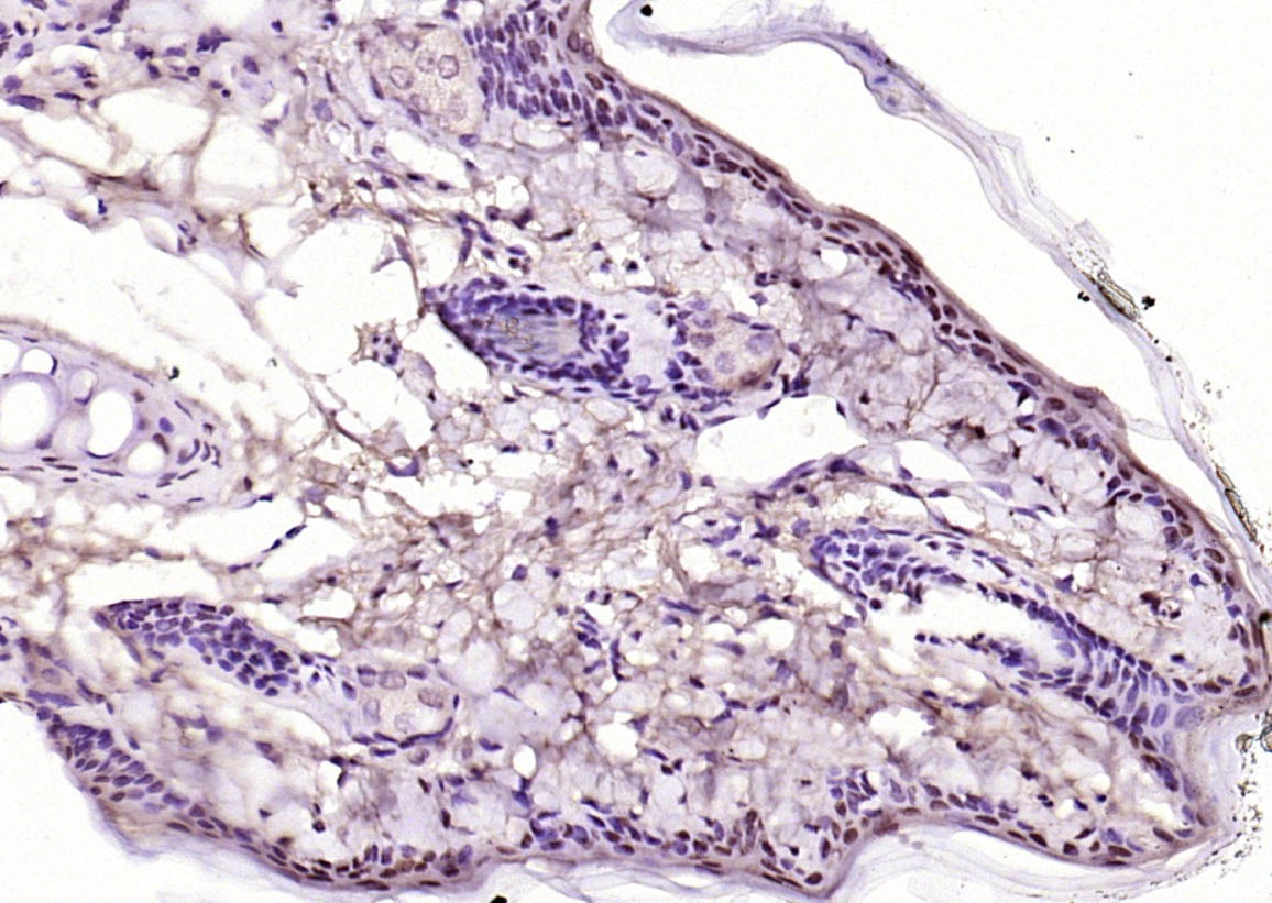 Anti-KEAP1 Polyclonal Antibody 2