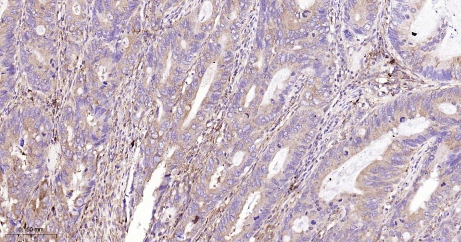Anti-IKBKB Polyclonal Antibody