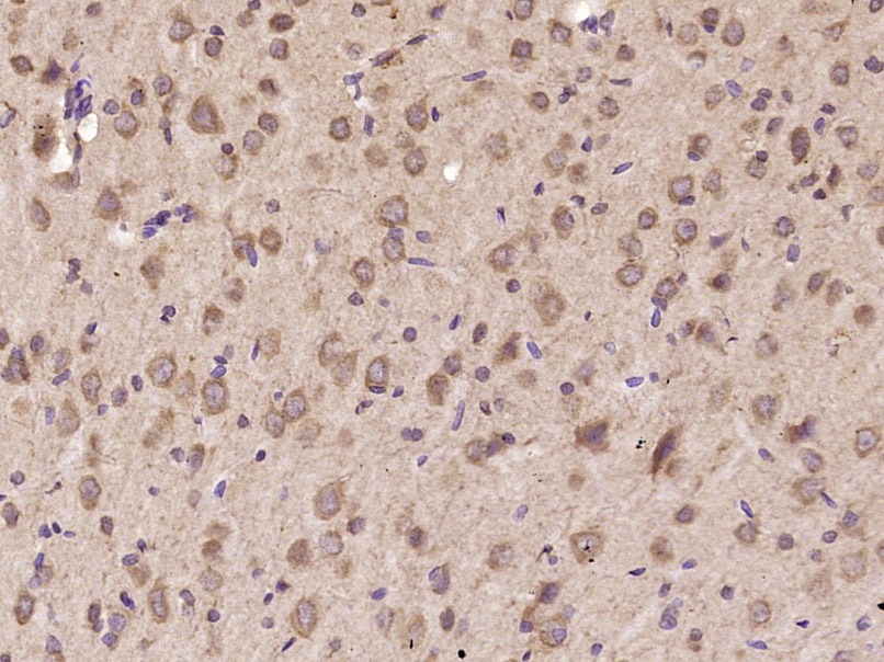Anti-IL-11 Polyclonal Antibody