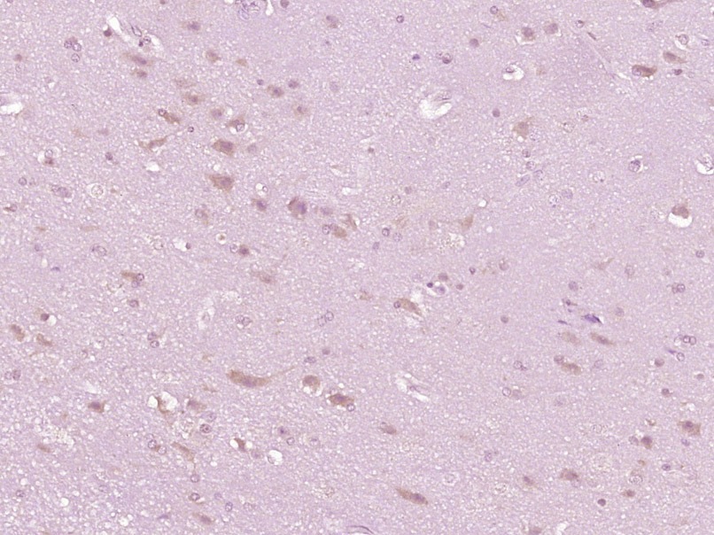 Anti-IL-10 Polyclonal Antibody 3