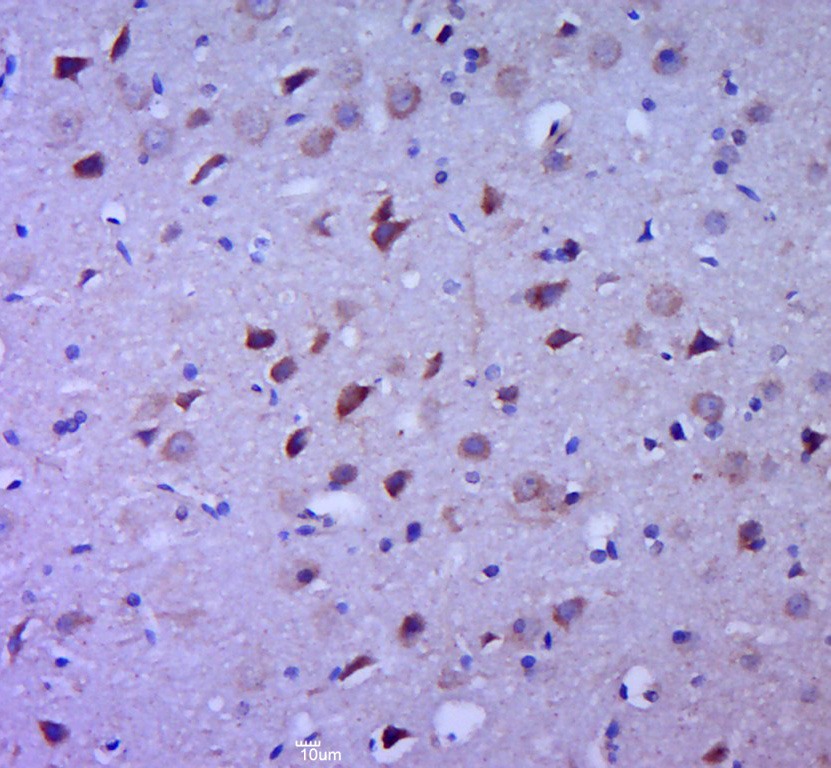Anti-IL-1 beta Polyclonal Antibody 3